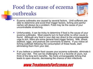 Food the cause of eczema outbreaks ,[object Object],[object Object],[object Object],http://www.treatmentsforeczema.net/ eczema cause,eczema trigger factor,Food the cause of eczema outbreaks,Food and eczema,how to determine Food which cause eczema,Food cause eczema,Trigger Eczema 