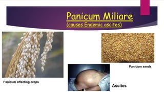 Panicum Miliare
(causes Endemic ascites)
Panicum affecting crops
Panicum seeds
Ascites
 