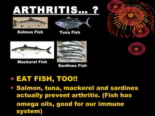 ARTHRITIS… ?

  Salmon Fish     Tuna Fish




  Mackerel Fish
                  Sardines Fish


• EAT FISH, TOO!!
• Salmon, tuna, mackerel and sardines
  actually prevent arthritis. (Fish has
  omega oils, good for our immune
  system)
 