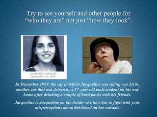 Try to see yourself and other people for        “who they are” not just “how they look”.In December 1999, the car in which Jacqueline was riding was hit by another car that was driven by a 17-year old male student on his way home after drinking a couple of hard packs with his friends.Jacqueline is Jacqueline on the inside- she now has to fight with your misperceptions about her based on her outside. 