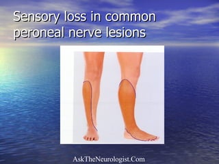 Sensory loss in common peroneal nerve lesions 