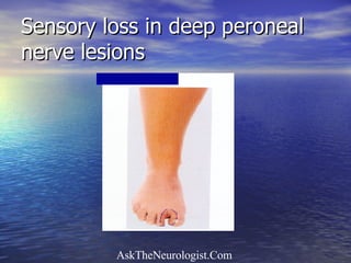 Sensory loss in deep peroneal nerve lesions 