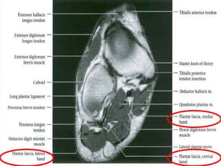 Foot Radiological Anatomy Shorouk Zaki