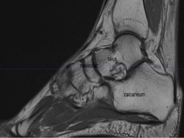 Foot radiological anatomy. shorouk zaki