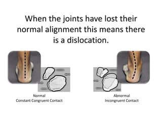 Foot Alignment - | PPTX