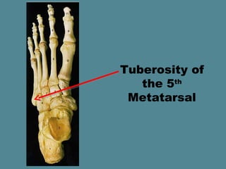 Tuberosity of
   the 5th
 Metatarsal
 