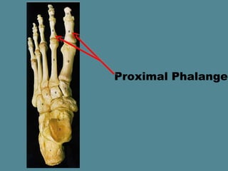 Proximal Phalange
 