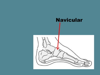 Navicular
 