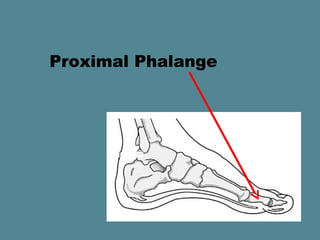 Proximal Phalange
 