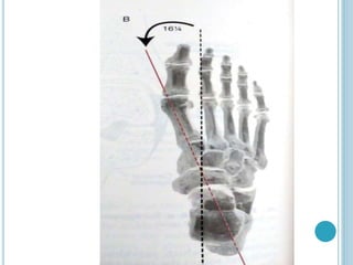 foot and ankle complex biomechanics pdf.. | PDF