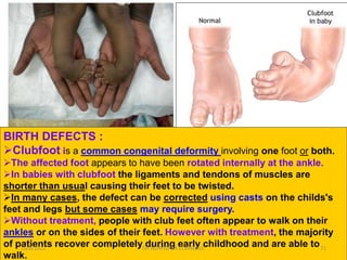 FOOT AND ANKLE.pptx
