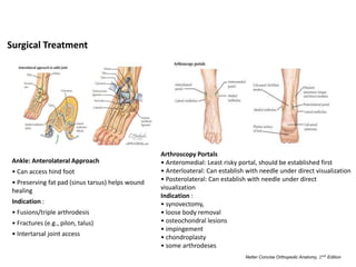 Surgical Treatment
Ankle: Anterolateral Approach
• Can access hind foot
• Preserving fat pad (sinus tarsus) helps wound
healing
Indication :
• Fusions/triple arthrodesis
• Fractures (e.g., pilon, talus)
• Intertarsal joint access
Arthroscopy Portals
• Anteromedial: Least risky portal, should be established first
• Anterloateral: Can establish with needle under direct visualization
• Posterolateral: Can establish with needle under direct
visualization
Indication :
• synovectomy,
• loose body removal
• osteochondral lesions
• impingement
• chondroplasty
• some arthrodeses
Netter Concise Orthopedic Anatomy, 2𝑛𝑑 Edition
 