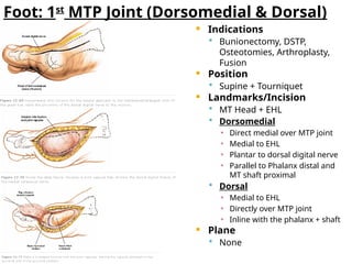 ORTH foot and ankle Surgical Approaches.pptx