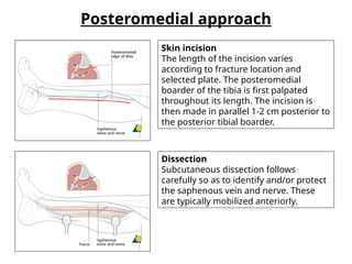 ORTH foot and ankle Surgical Approaches.pptx