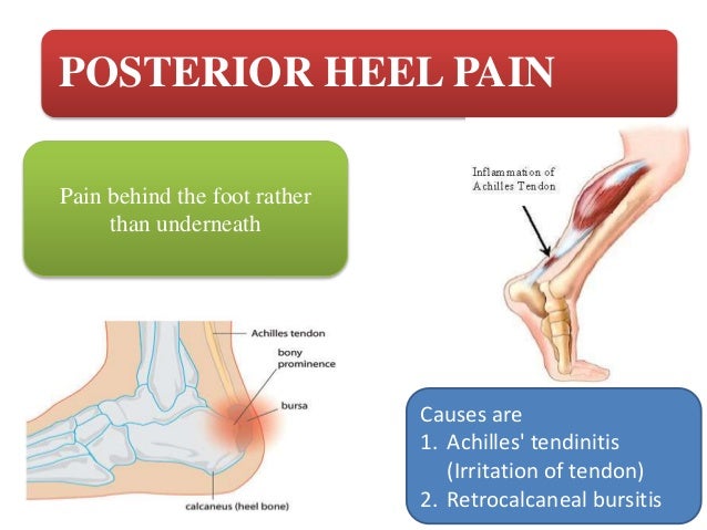 severe pain on back of heel