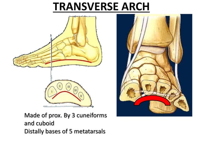 Foot arch deformities 2