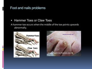 Aging ligamentswww.laboratorium.dist.unige.it