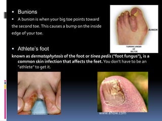 195 lbs when walking