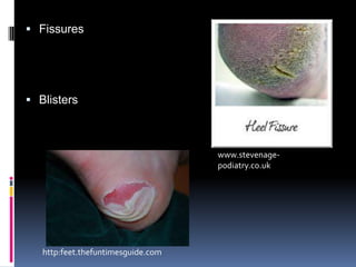 390 lbs when runningBalancenerves transmit to the brain signal about the level underneath. 