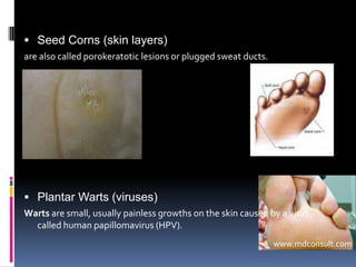 ankles are triple jointed to articulate the body balanceSmooth gaitlever action of the toeswww.localwin.com