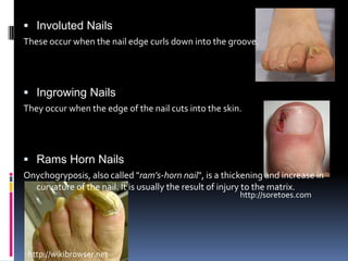 DiabetesType 1 (insulin dependent)Type 2 (non-insulin dependent)ComplicationsFoot care 