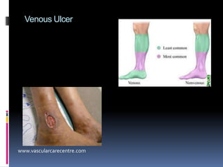 Anatomy of the Footwww.wheniwearmysneakers.comhttp://legrandclub.rds.ca