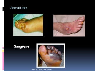 Common foot problemshttp://www.marshfieldclinic.org