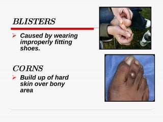 Improper Fitting Foot Care 8 | PPT