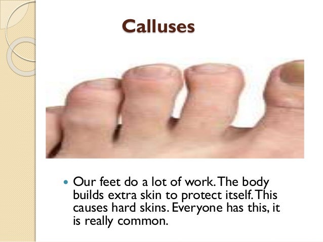 foot corn specialist near me