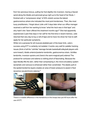 from her peroneus brevus, pulling her foot slightly into inversion, tracing a fascial
spiral along the tibialis and peroneal group right up to the head of her fibula. I
finished with a “compression strap” of 50% stretch across the lateral
gastrocnemius where she indicated the most point tenderness. Then, like most
busy practitioners, I forgot about Julie until 3 days later when our office manager
received a call from her wanting to know “what the heck was in that tape” and
why hadn’t she “been offered this treatment months ago?” She had apparently
experienced 2 pain-free days in her calf for the first time in recent memory. Julie
returned that very day to buy a roll of tape and to have me show her how to self-
apply for her particular symptoms.
While not a panacea for all musculo-skeletal pain of the lower limb, Julie’s
success using ETT is certainly not isolated. It works very well for patellar tracking
issues (think of all the “colt-like” teenage female basketball/volleyball players with
sore knees!), tibialis anterior/posterior tendonitis, gastrocnemius strain, Achilles
tendonitis, inversion sprains and (here’s the semi-magical part) edema! The
protocol for contusion and edema is nothing short of fascinating. Because the
tape literally lifts the skin, rather than compressing it, the micro-circulatory system
(lymphatic and venous) is enhanced rather than constricted. The elastic pull on
the epidermis/dermis layers creates an area of lower pressure to assist in fluid
dynamics (acute/chronic edema).5
There’s a notable difference in the hematoma on this biceps tear just 48 hours after the
use of ETT.
 