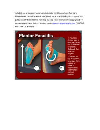Included are a few common musculoskeletal conditions where foot care
professionals can utilize elastic therapeutic tape to enhance proprioception and
quite possibly the outcome. For step-by-step video instruction on applying ETT
for a variety of lower limb complaints, go to www.rocktapecanada.com (VIDEOS
then “FEET & HANDS”)
 