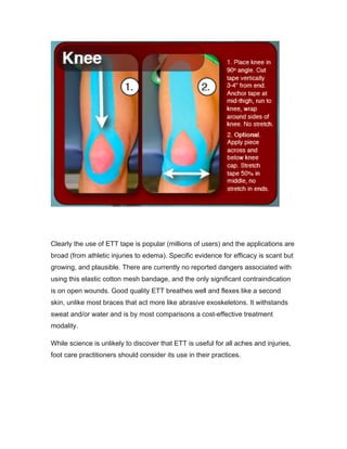 Clearly the use of ETT tape is popular (millions of users) and the applications are
broad (from athletic injuries to edema). Specific evidence for efficacy is scant but
growing, and plausible. There are currently no reported dangers associated with
using this elastic cotton mesh bandage, and the only significant contraindication
is on open wounds. Good quality ETT breathes well and flexes like a second
skin, unlike most braces that act more like abrasive exoskeletons. It withstands
sweat and/or water and is by most comparisons a cost-effective treatment
modality.
While science is unlikely to discover that ETT is useful for all aches and injuries,
foot care practitioners should consider its use in their practices.
 