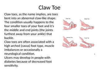 Types of Foot Deformities among human being | PPTX