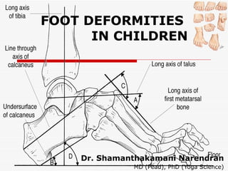FOOT DEFORMITIES  IN CHILDREN Dr. Shamanthakamani Narendran  MD (Pead), PhD (Yoga Science) 