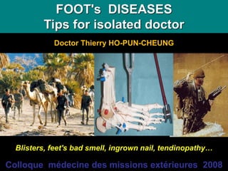 Doctor Thierry HO-PUN-CHEUNG
Blisters, feet's bad smell, ingrown nail, tendinopathy…
FOOT's DISEASES
Tips for isolated doctor
Colloque médecine des missions extérieures 2008
 