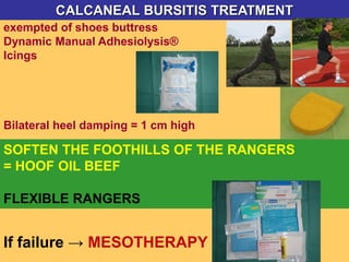 exempted of shoes buttress
Dynamic Manual Adhesiolysis®
Icings
Bilateral heel damping = 1 cm high
CALCANEAL BURSITIS TREATMENT
SOFTEN THE FOOTHILLS OF THE RANGERS
= HOOF OIL BEEF
FLEXIBLE RANGERS
If failure → MESOTHERAPY
 