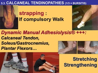 Dynamic Manual Adhesiolysis® +++:
Calcaneal Tendon,
Soleus/Gastrocnemius,
Plantar Flexors…
Stretching
Strengthening
5.3. CALCANEAL TENDINOPATHIES (1/3 = BURSITIS)
strapping :
If compulsory Walk
 