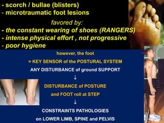 - scorch / bullae (blisters)
- microtraumatic foot lesions
favored by:
- the constant wearing of shoes (RANGERS)
- intense physical effort , not progressive
- poor hygiene
however, the foot
= KEY SENSOR of the POSTURAL SYSTEM
ANY DISTURBANCE of ground SUPPORT

DISTURBANCE of POSTURE
and FOOT roll at STEP

CONSTRAINTS PATHOLOGIES
on LOWER LIMB, SPINE and PELVIS
3
 
