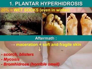 1. PLANTAR HYPERHIDROSIS
20% = WET SOCKS (even in winter)
Aftermath :
→ maceration + soft and fragile skin

- scorch, blisters
- Mycosis
- Bromhidrose (horrible smell)
 