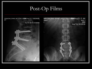 Post-Op Films
 