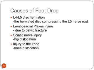 Drop Injury Foot drop | PPTX