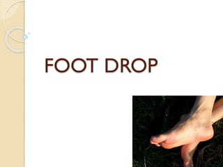 FOOT DROP
 