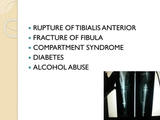  RUPTURE OF TIBIALIS ANTERIOR
 FRACTURE OF FIBULA
 COMPARTMENT SYNDROME
 DIABETES
 ALCOHOL ABUSE
 