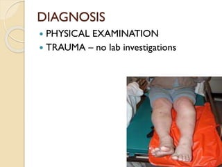 DIAGNOSIS
 PHYSICAL EXAMINATION
 TRAUMA – no lab investigations
 