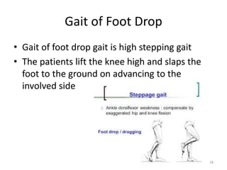 • Gait of foot drop gait is high stepping gait
• The patients lift the knee high and slaps the
foot to the ground on advancing to the
involved side
18
Gait of Foot Drop
 