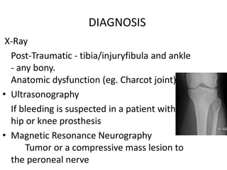 X-Ray
Post-Traumatic - tibia/injuryfibula and ankle
- any bony.
Anatomic dysfunction (eg. Charcot joint)
• Ultrasonography
If bleeding is suspected in a patient with a
hip or knee prosthesis
• Magnetic Resonance Neurography
Tumor or a compressive mass lesion to
the peroneal nerve
DIAGNOSIS
 