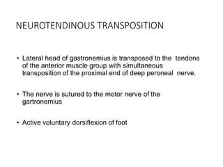 Footdrop | PPTX | Death, Injury, or Military Conflict | Sensitive Topics