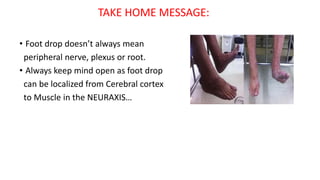 TAKE HOME MESSAGE:
• Foot drop doesn’t always mean
peripheral nerve, plexus or root.
• Always keep mind open as foot drop
can be localized from Cerebral cortex
to Muscle in the NEURAXIS…
 