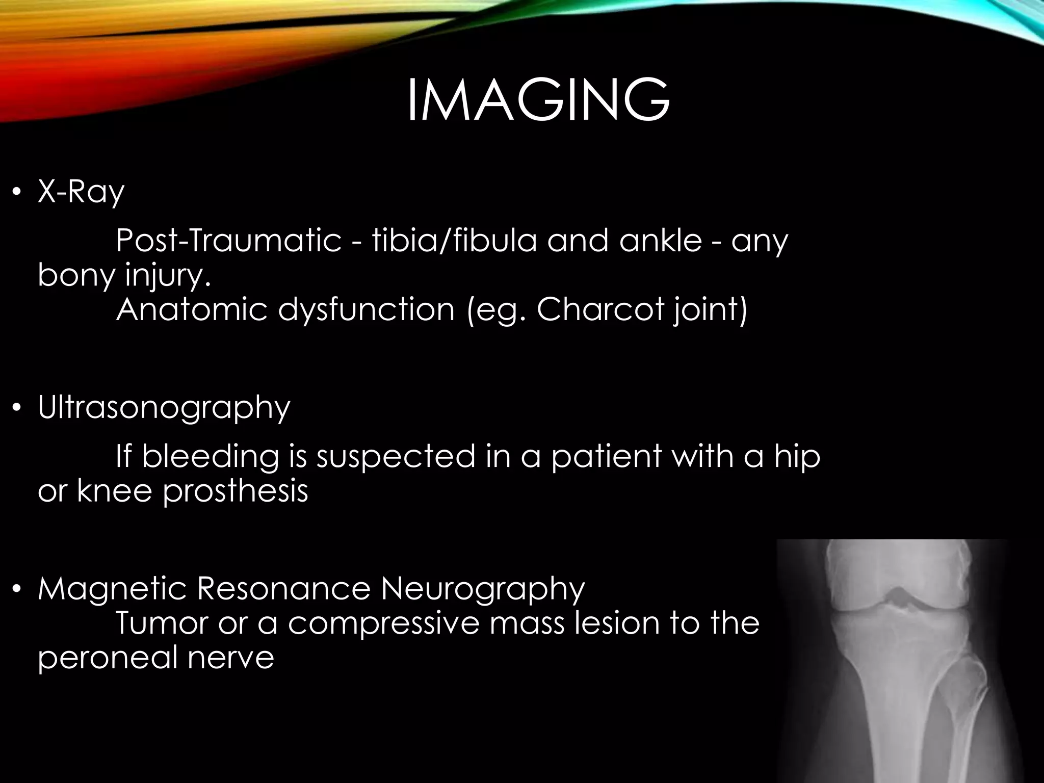 IMAGING 
• X-Ray 
Post-Traumatic - tibia/fibula and ankle - any 
bony injury. 
Anatomic dysfunction (eg. Charcot joint) 
• Ultrasonography 
If bleeding is suspected in a patient with a hip 
or knee prosthesis 
• Magnetic Resonance Neurography 
Tumor or a compressive mass lesion to the 
peroneal nerve 
 