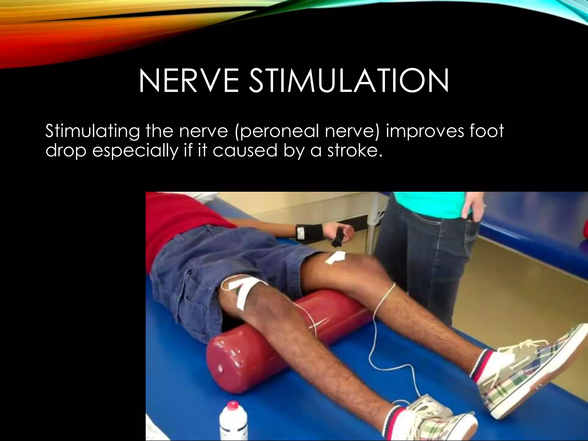 NERVE STIMULATION 
Stimulating the nerve (peroneal nerve) improves foot 
drop especially if it caused by a stroke. 
 